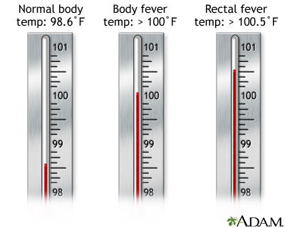 Thermometer temperature