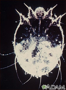 Scabies mite, photomicrograph