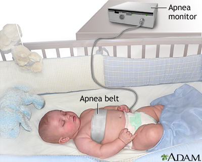 Apnea monitor