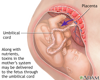 Substance abuse during pregnancy