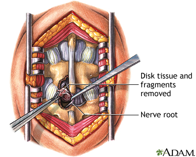 Procedure