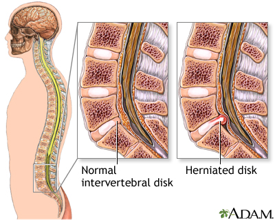 Normal anatomy