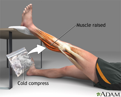 Treatment for leg strain