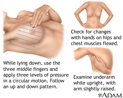 Breast self-exam