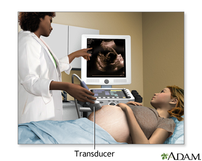 Ultrasound in pregnancy