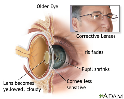 Aged eye anatomy