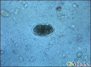 Hookworm egg