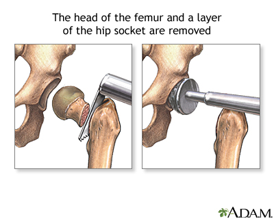 Procedure, part 1