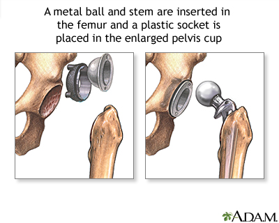 Procedure, part 2