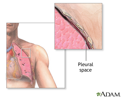 Normal anatomy