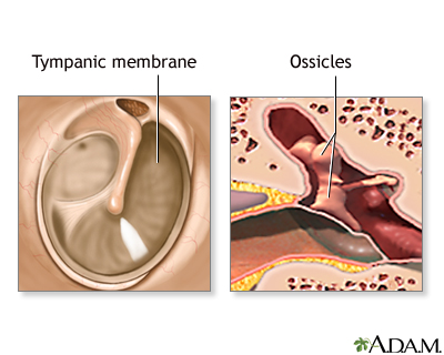 Normal anatomy