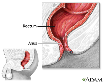 Normal anatomy