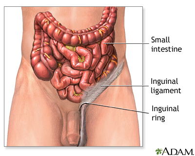 Normal anatomy