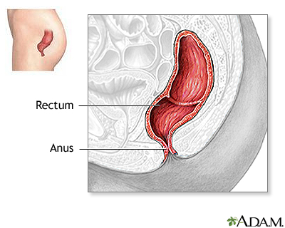 Normal anatomy