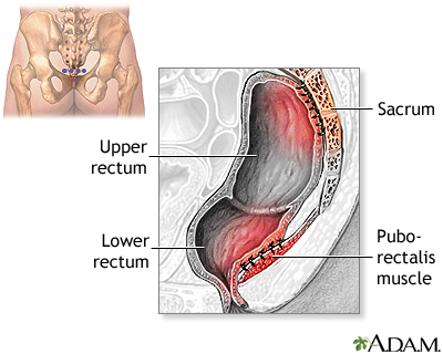 Procedure