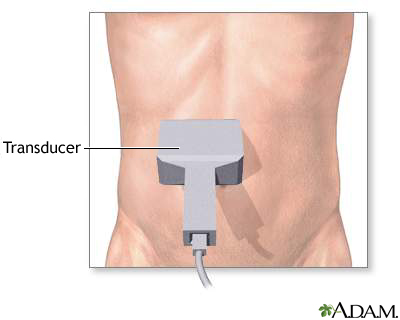 Abdominal ultrasound