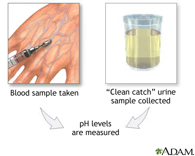 PH urine test