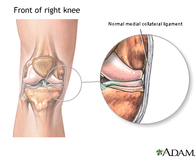 Medial collateral ligament