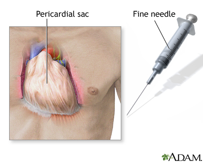 Pericardium