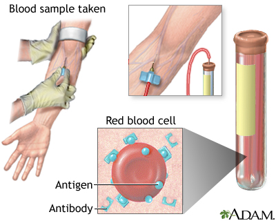 Antibody titer