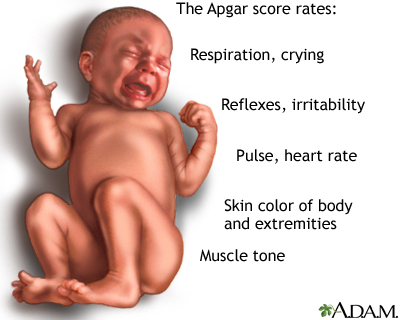 Newborn test