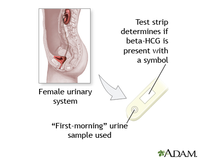 Pregnancy test