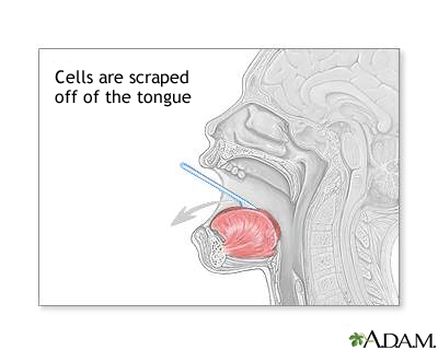 Buccal  smear