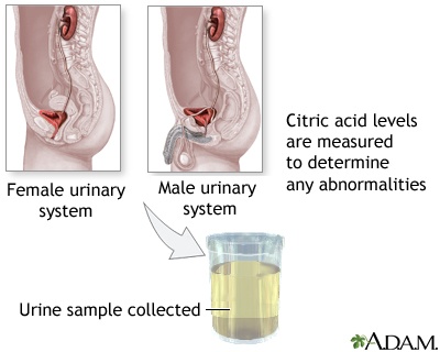 Citric acid urine test