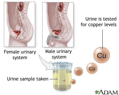 Copper urine test