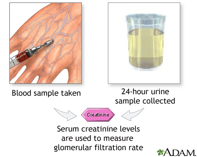 Creatinine tests