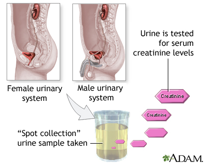 Creatinine urine test