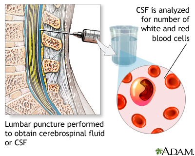 CSF cell count