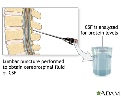 CSF protein test