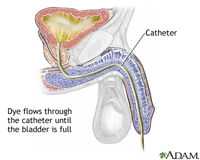 Cystography