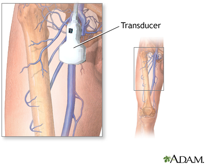 Doppler ultrasonography of an extremity