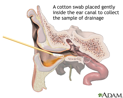 Ear drainage culture