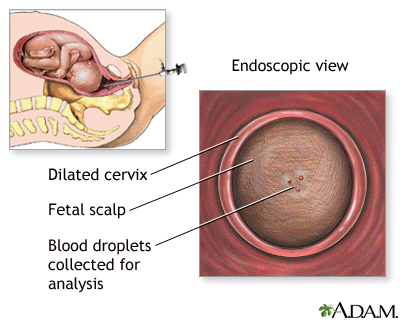 Fetal blood testing