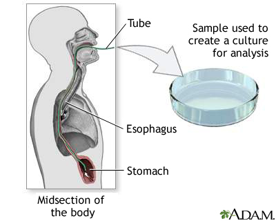 Culture of gastric tissue biopsy