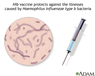 Hib immunization (vaccine)