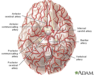 Arteries of the brain