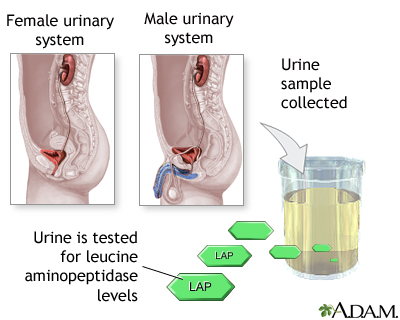 Leucine aminopeptidase urine test