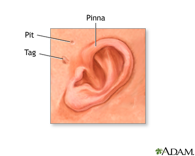 Newborn ear anatomy