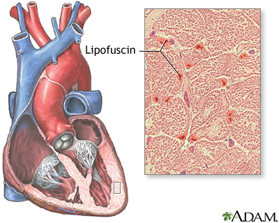 Lipofuscin