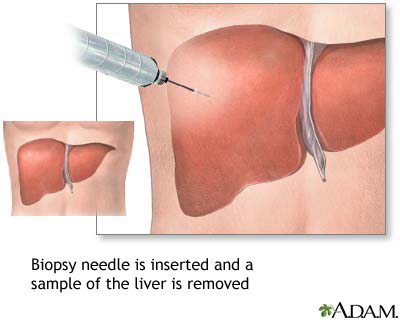 Liver culture