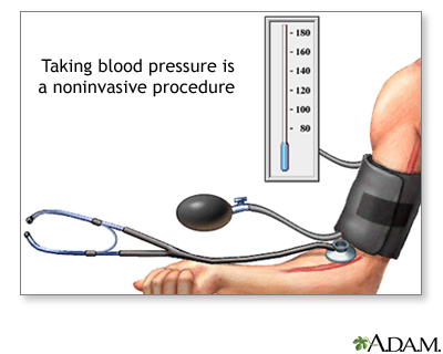 Noninvasive test