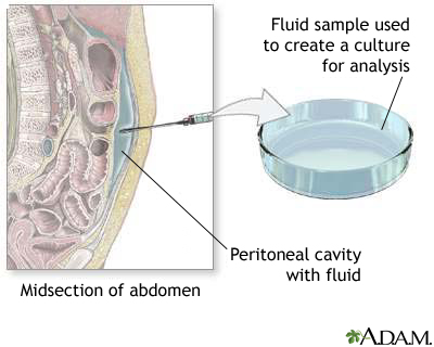 Peritoneal culture