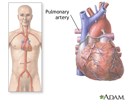 Pulmonary arteries