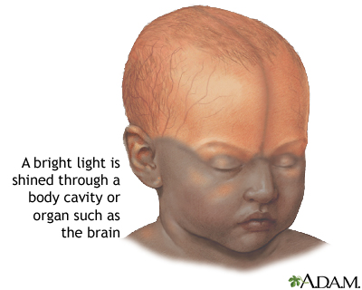 Infant brain test