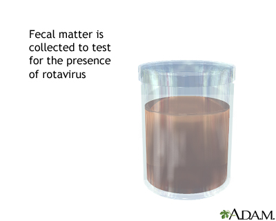 Fecal sample