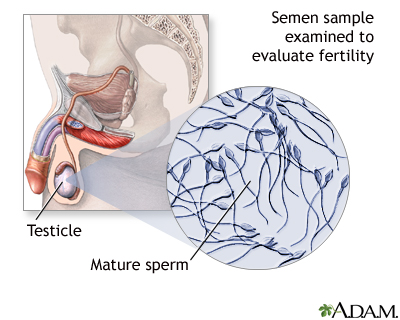 Semen analysis